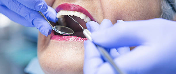 Best Emergency Tooth Extraction in Woodville, FL